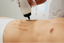 ¿Cómo eliminar el vello en del abdomen?