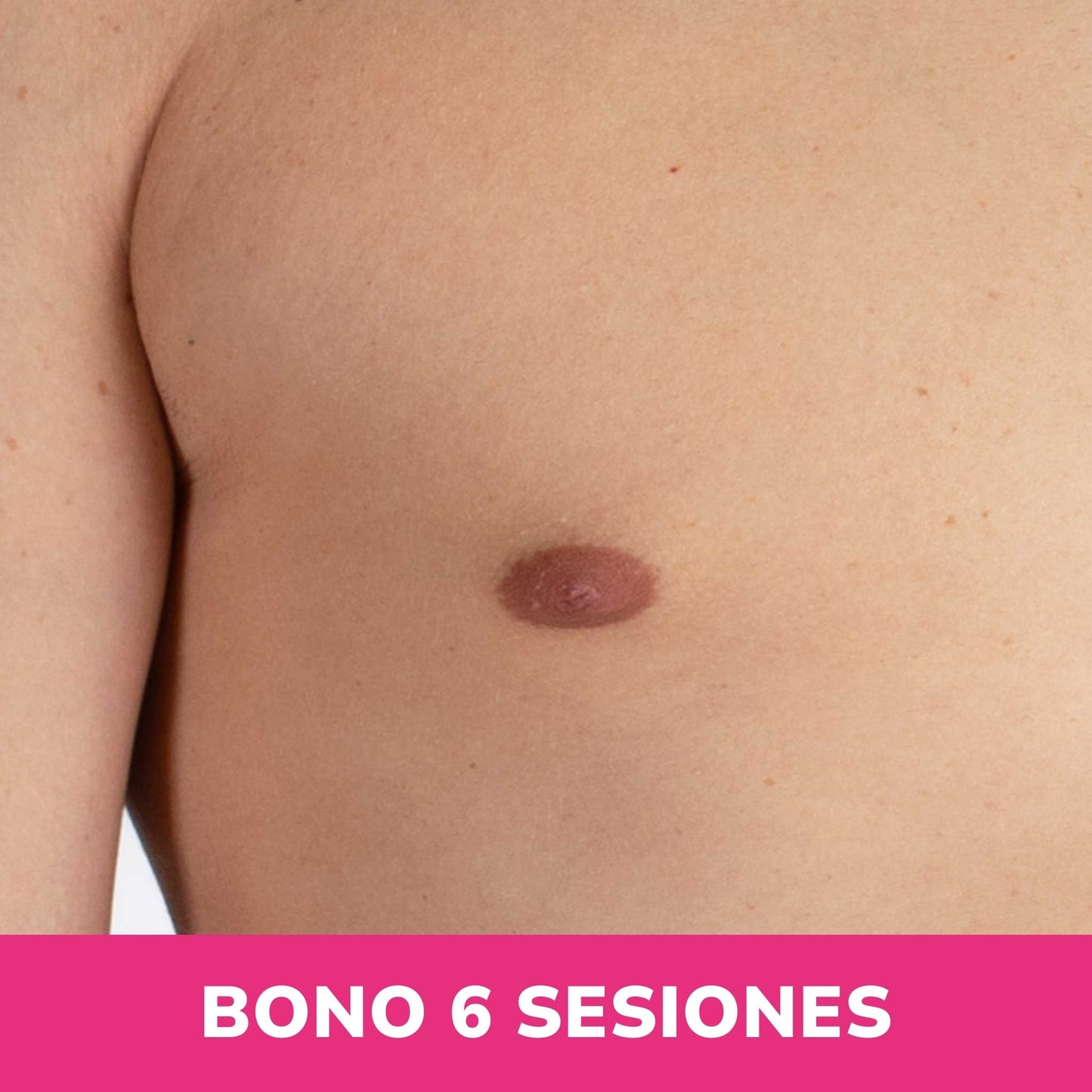Areola Hombre 2 sesiones